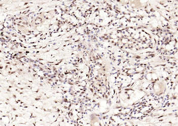 Phospho-STAT3 (Tyr705) Mouse Monoclonal Antibody