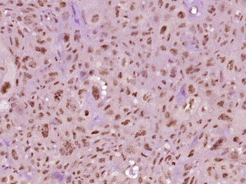 Phospho-STAT3 (Tyr705) Mouse Monoclonal Antibody