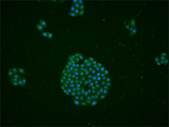 Phospho-AMPK beta 1 + AMPK beta 2 (Ser182/Ser184) Rabbit Polyclonal Antibody