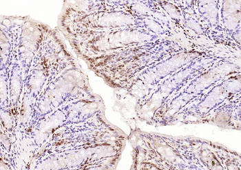 Phospho-NFKB p65 (Ser311) Rabbit Polyclonal Antibody