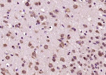 Phospho-LRRK2 (Thr1410) Rabbit Polyclonal Antibody