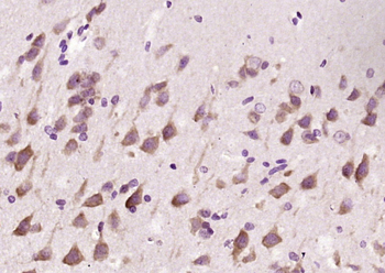 Phospho-LRRK2 (Thr1410) Rabbit Polyclonal Antibody