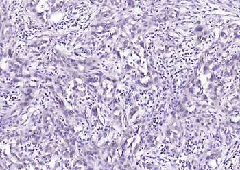 Phospho-AKT (Ser473) Mouse Monoclonal Antibody