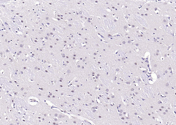 Phospho-AKT (Ser473) Mouse Monoclonal Antibody