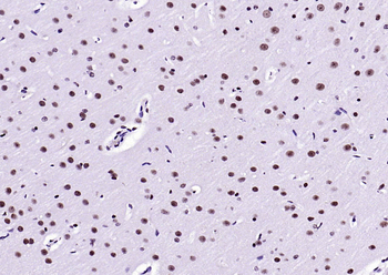 Phospho-Nrf2 (Ser40) Recombinant Rabbit Monoclonal Antibody