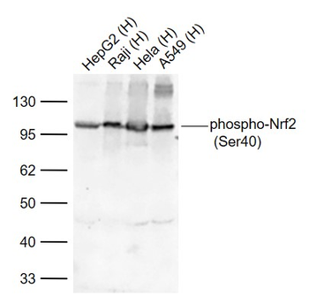 Phospho-Nrf2 (Ser40) Recombinant Rabbit Monoclonal Antibody