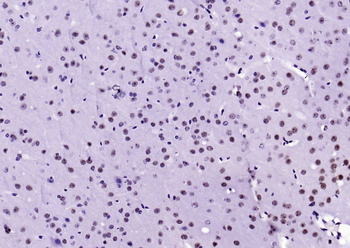 Phospho-Nrf2 (Ser40) Recombinant Rabbit Monoclonal Antibody