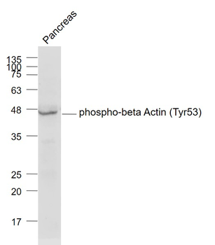 Phospho-beta Actin (Tyr53) Rabbit Polyclonal Antibody