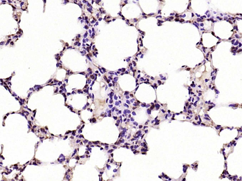 Phospho-C-Myc (Ser62) Rabbit Polyclonal Antibody