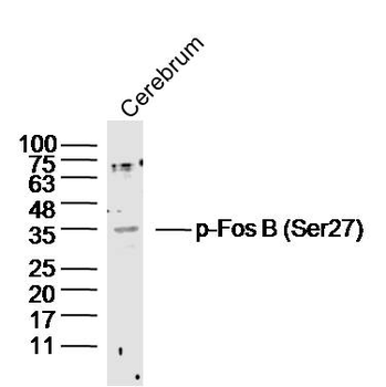 Phospho-Fos B (Ser27) Rabbit Polyclonal Antibody
