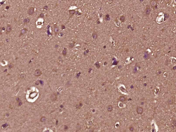 Phospho-AMPK alpha 1 (Ser496) Rabbit Polyclonal Antibody