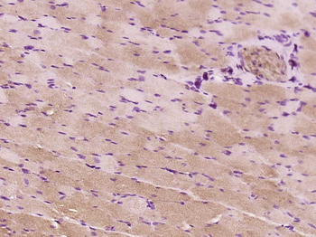 Phospho-AMPK alpha 1 (Ser496) Rabbit Polyclonal Antibody