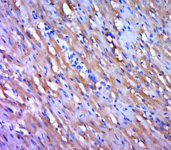 Phospho-HSL (Ser863) Rabbit Polyclonal Antibody