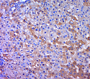 Phospho-HSL (Ser863) Rabbit Polyclonal Antibody
