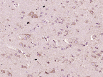 Phospho-Gli1 (T101/ S102/S104) Rabbit Polyclonal Antibody