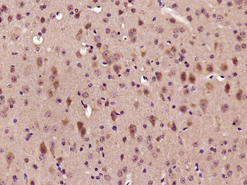 Phospho-beta Catenin (Ser37) Rabbit Polyclonal Antibody