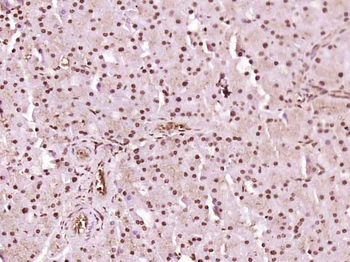 Phospho-beta Catenin (Ser37) Rabbit Polyclonal Antibody