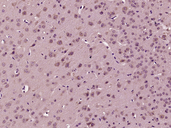 Phospho-IRS1 (Ser323) Rabbit Polyclonal Antibody