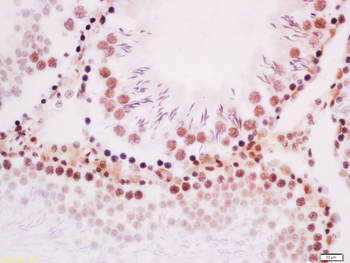 Phospho-ROCK2 (Tyr256) Rabbit Polyclonal Antibody