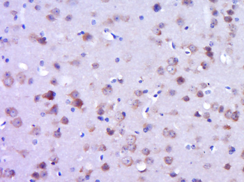 Phospho-FAK (Tyr925) Rabbit Polyclonal Antibody