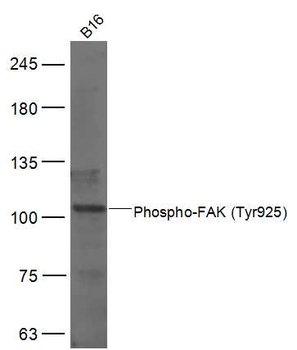 Phospho-FAK (Tyr925) Rabbit Polyclonal Antibody