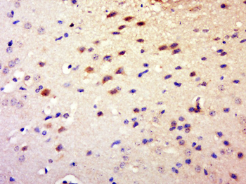 Phospho-IFNGR1 (Tyr457) Rabbit Polyclonal Antibody