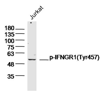 Phospho-IFNGR1 (Tyr457) Rabbit Polyclonal Antibody