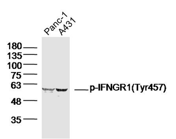 Phospho-IFNGR1 (Tyr457) Rabbit Polyclonal Antibody