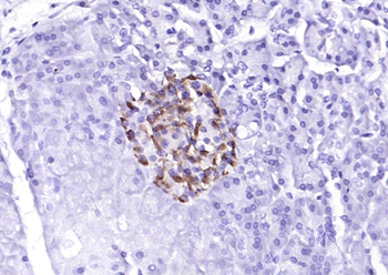 Phospho-PERK (Thr980) Rabbit Polyclonal Antibody