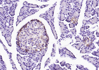 Phospho-PERK (Thr980) Rabbit Polyclonal Antibody