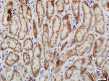 Phospho-PERK (Thr980) Rabbit Polyclonal Antibody