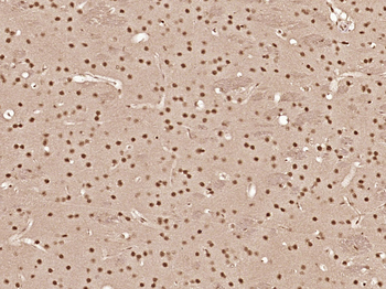 Phospho-AMPK alpha 1 (Ser356) Rabbit Polyclonal Antibody