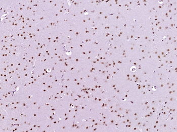 Phospho-ATF2 (Ser94) Rabbit Polyclonal Antibody