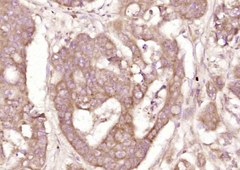 Phospho-DDX58 (Thr170) Rabbit Polyclonal Antibody