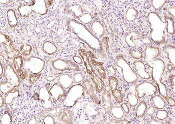 Phospho-DDX58 (Thr170) Rabbit Polyclonal Antibody