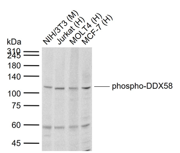 Phospho-DDX58 (Thr170) Rabbit Polyclonal Antibody