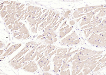 Phospho-Desmin (Thr76 + Thr77) Rabbit Polyclonal Antibody