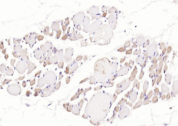 Phospho-Desmin (Thr76 + Thr77) Rabbit Polyclonal Antibody