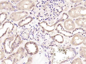 Phospho-Dnmt1 (Ser154) Rabbit Polyclonal Antibody