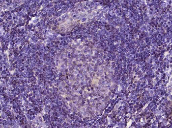 Phospho-Dnmt1 (Ser154) Rabbit Polyclonal Antibody