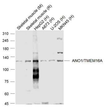 ANO1/DOG1 Rabbit Polyclonal Antibody