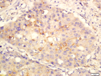 ANO1/DOG1 Rabbit Polyclonal Antibody