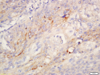 ANO1/DOG1 Rabbit Polyclonal Antibody