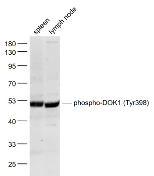 Phospho-DOK1 (Tyr398) Rabbit Polyclonal Antibody