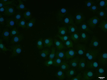 Phospho-E2F1 (Ser364) Rabbit Polyclonal Antibody