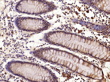 Phospho-E2F1 (Ser364) Rabbit Polyclonal Antibody
