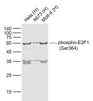 Phospho-E2F1 (Ser364) Rabbit Polyclonal Antibody