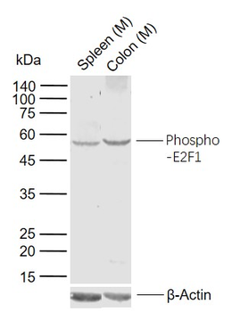 Phospho-E2F1 (Ser337) Rabbit Polyclonal Antibody