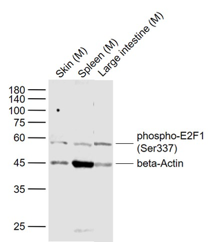 Phospho-E2F1 (Ser337) Rabbit Polyclonal Antibody