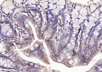 Phospho-E2F1 (Ser332) Rabbit Polyclonal Antibody